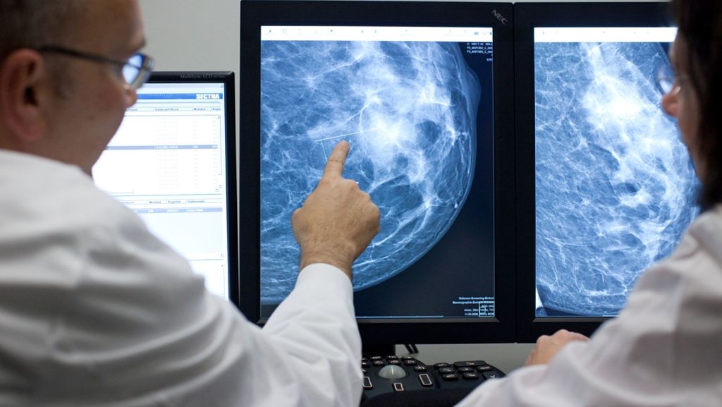 Medizin: Gentests für wirkungsvollere Therapie bei Brustkrebs