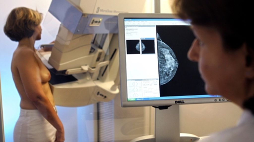 Brustkrebs-Früherkennung: Streit über die Mammografie