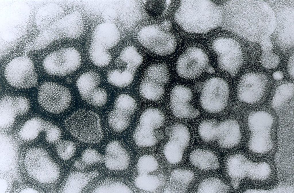 Platz 4 Vogelgrippe-Virus: Alle paar Jahre gibt es Schlagzeilen über die Vogelgrippe: So sterben an dem Virus sieben von zehn Menschen. Doch die Gefahr, an dem Virus zu erkranken, ist gering. Der Mensch kann sich nur bei engem Kontakt zu Hühnern und Vögeln infizieren.