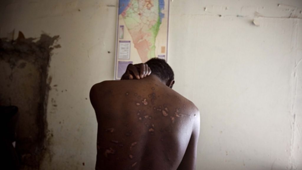 Hilfe für Folteropfer: „Es sind Menschen, die keiner haben will“