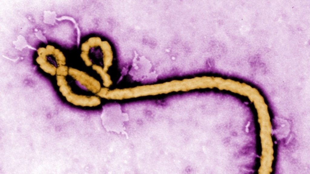 Kosten bei fast vier Milliarden Euro: WHO sieht bei Ebola Trendwende