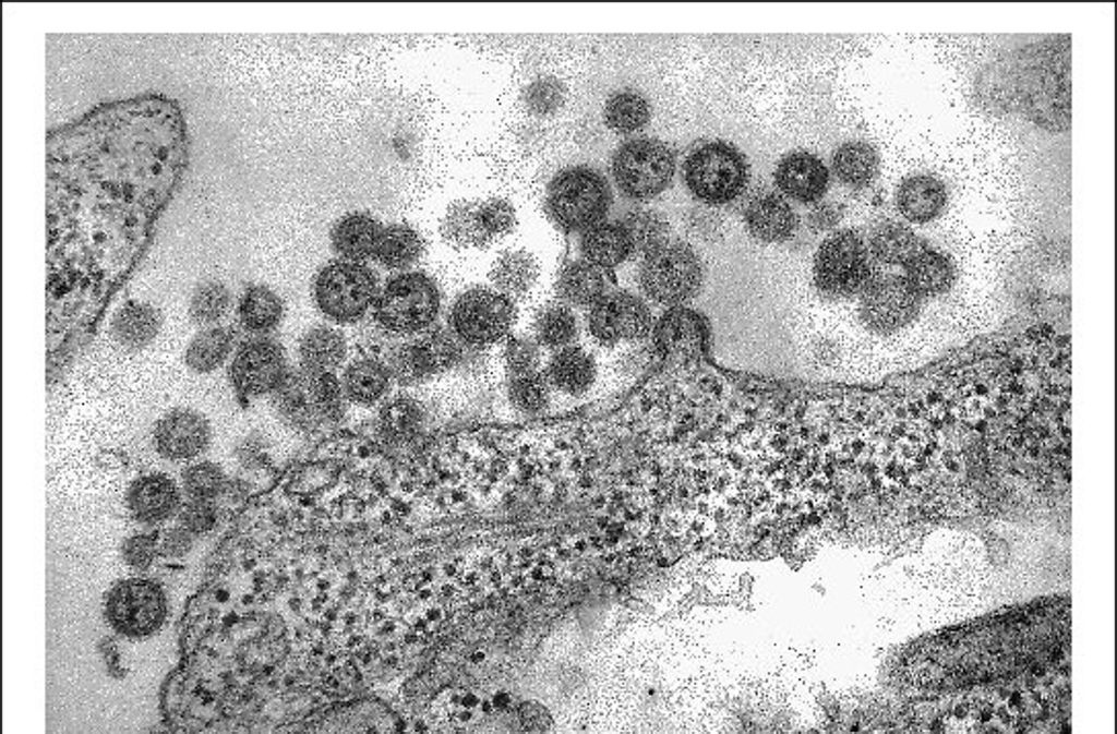 Platz 8 Machupo-Virus: Das Virus, das in Bolivien vorkommt, ruft starkes Fieber hervor. Auch hier blutet es aus Mund, Nase und Augen – bis die Organe versagen. Drei von zehn Menschen sterben daran. Das Virus kommt in vielen Mäusen vor, kann aber auch von Mensch zu Mensch übertragen werden
