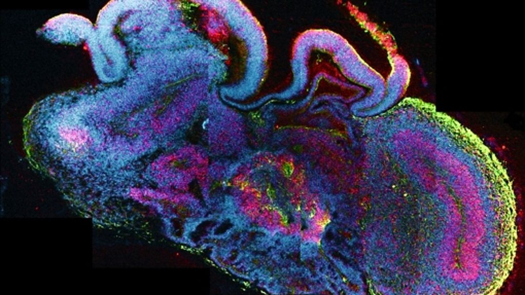 Stammzellforschung: Gehirne im Tank