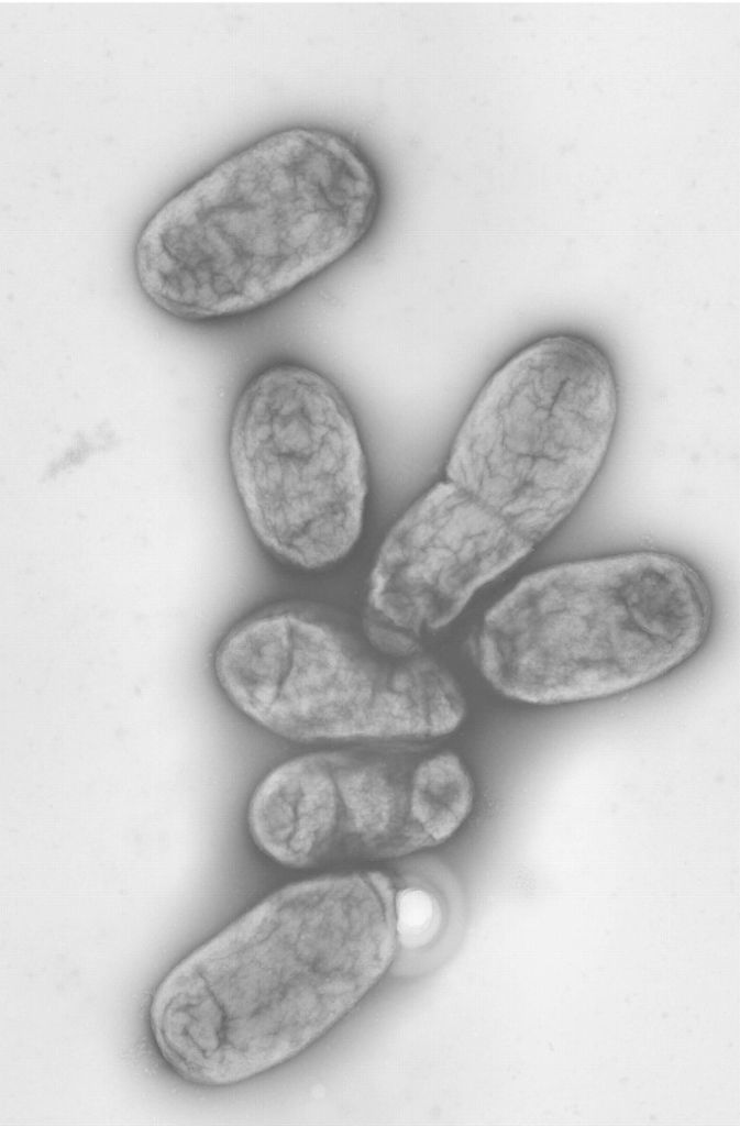 Diese elektronenmikroskopische Aufnahme zeigt das Pestbakterium Yersinia pestis.