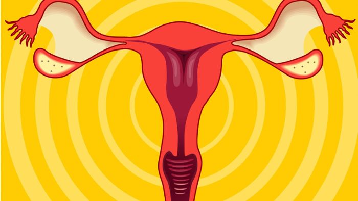 Lasst uns über ... Sterilisation reden: Wenn Frauen sich für einen unumkehrbaren Eingriff entscheiden