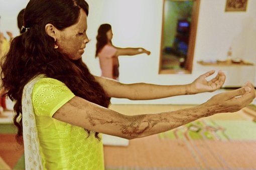Mit 15 Jahren wurde Laxmi Agarwal mit Säure überschüttet. Doch sie lebt ihr Leben als Mutter und Aktivistin – und macht Yoga. Foto: AFP