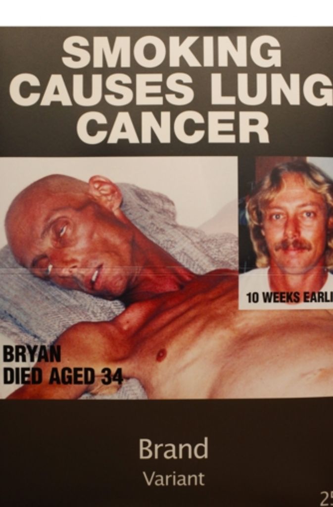 „Rauchen verursacht Lungenkrebs. Brian starb mit 34. So sah er zehn Wochen vor der großen Aufnahme aus.“