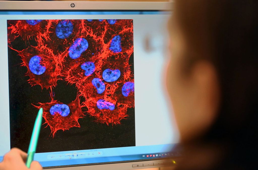Bei der Analyse von Melanom-Zellen  soll künstliche Intelligenz helfen. Foto: dpa