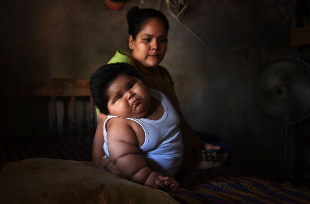 Der kleine Mexikaner Luis Manuel Gonzales ist noch nicht einmal ein Jahr alt - und bringt bereits 28 Kilo auf die Waage.