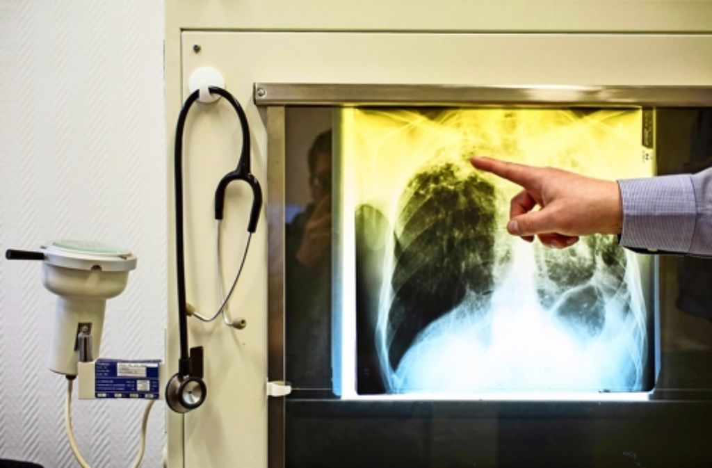 Die Tuberkulose betrifft bevorzugt die Lunge. Die Krankheit ist meldepflichtig. Foto: dpa
