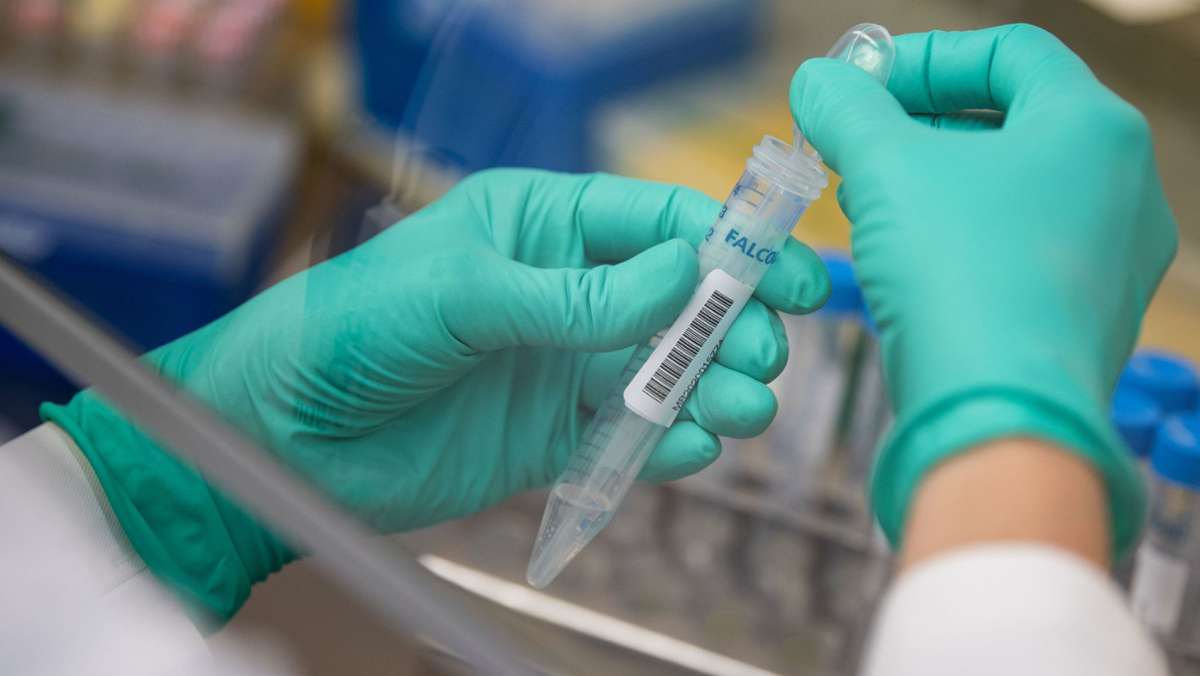 Coronavirus in Deutschland: Bareiß: Kostenpflichtige Corona-Tests für Impfverweigerer gerecht