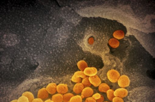 Eine elektronenmikroskopische Aufnahme des „U.S. National Institute of Health“ zeigt das Coronavirus, das aus der Oberfläche von im Labor kultivierten Zellen austritt. Das Virus passt sich durch Mutationen ständig seinem neuen Wirt, dem Menschen an. Foto: NIAID-RML/AP/dpa