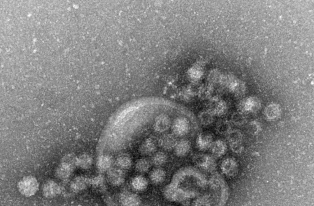 Der Virus benötigt nur wenige Einheiten, um infektiös zu sein.