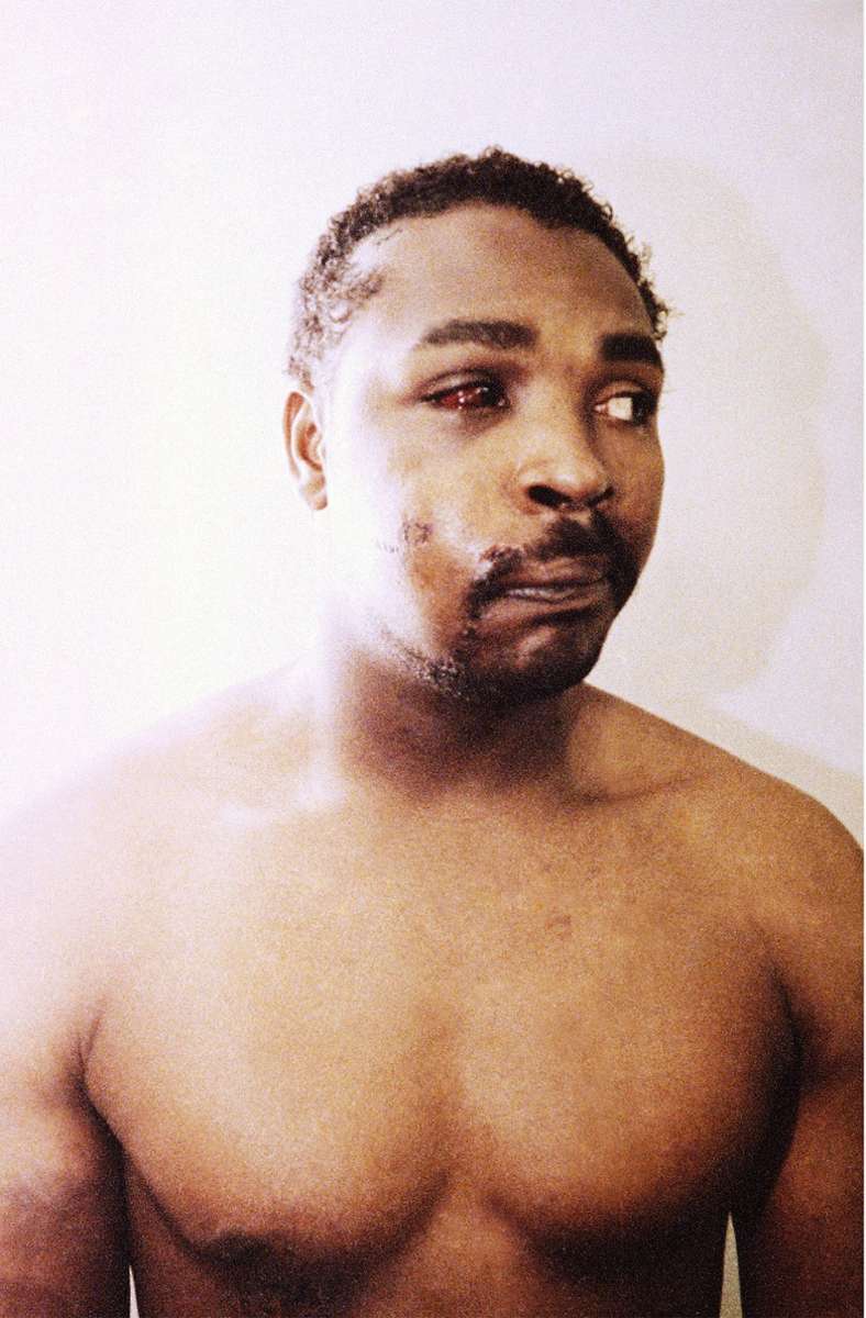 Nach dem sie ihn gestellt haben, schlagen und treten die Polizisten mehr als 50 Mal auf ihn ein. Das Bild zeigt ihn drei Tage nach seiner Festnahme. Ein Anwohner filmt den Vorfall.