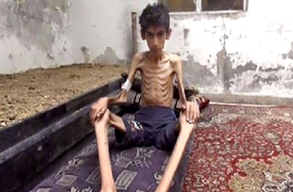 Bilder wie diese haben international Entsetzen ausgelöst. Viele Menschen in Madaja leiden unter einer lebensbedrohlichen Unterernährung.