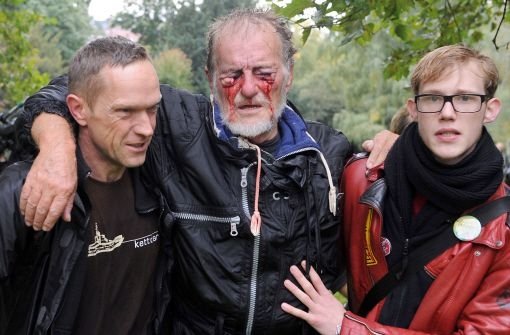 ... - einige Demonstranten erleiden folgenschwere Augenverletzungen und erblinden ganz oder teilweise.  Foto: dpa