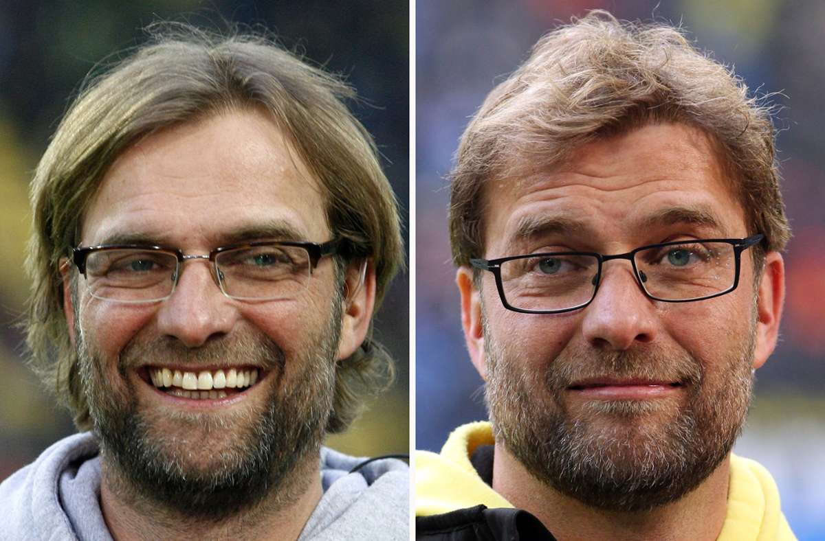 Der Fußballtrainer Jürgen Klopp vor und nach seiner Haartransplantation.