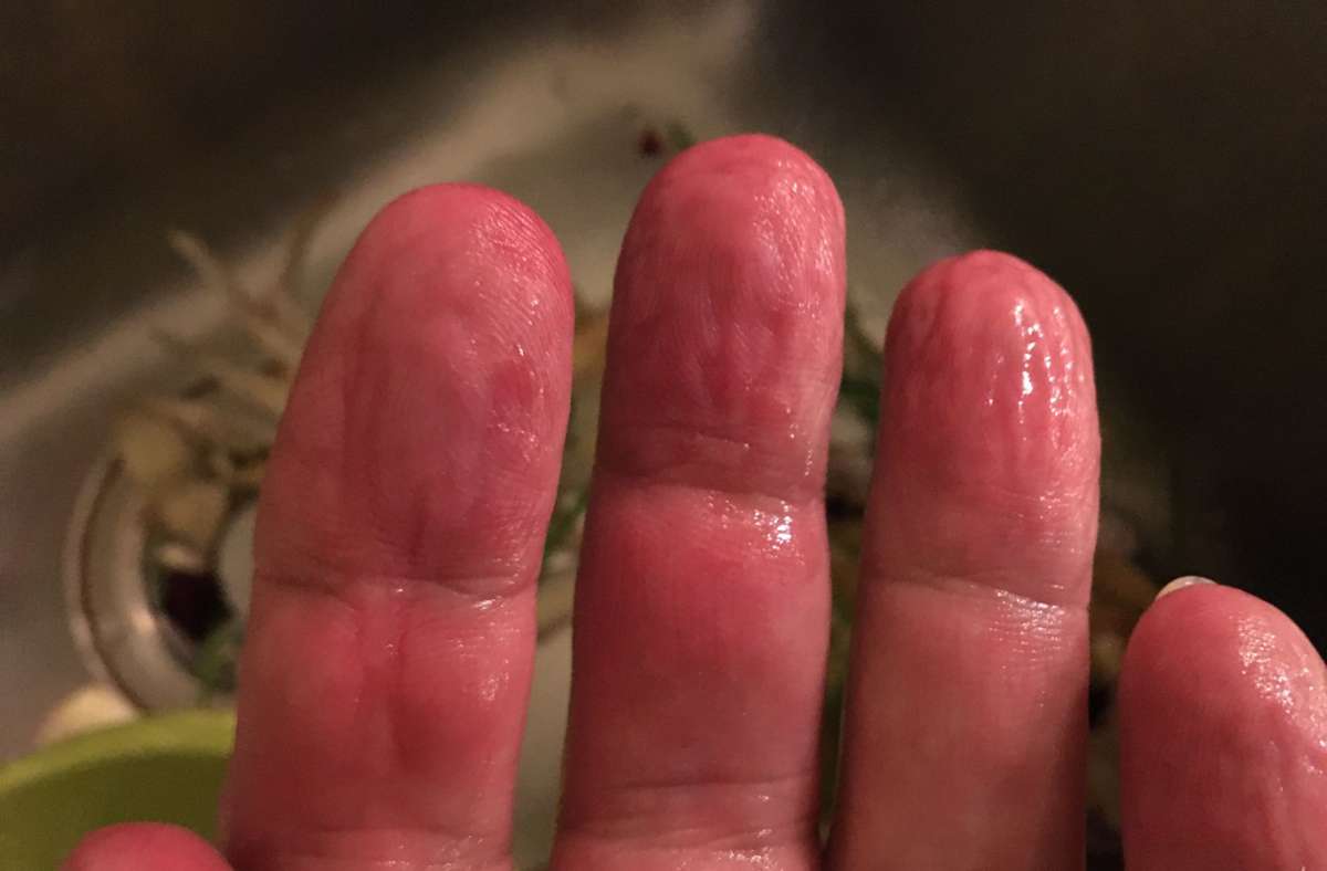 Nach dem Schälen sind die Finger etwas rot, . . .