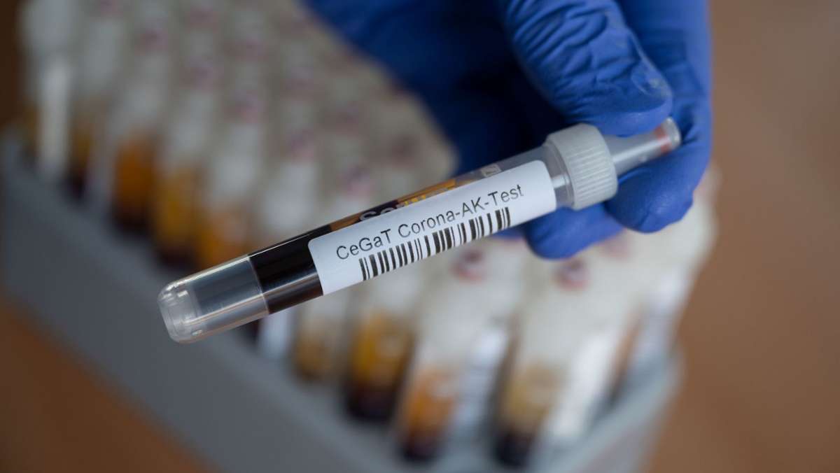 Coronavirus: Bundesweite Antikörper-Studie startet in Reutlingen