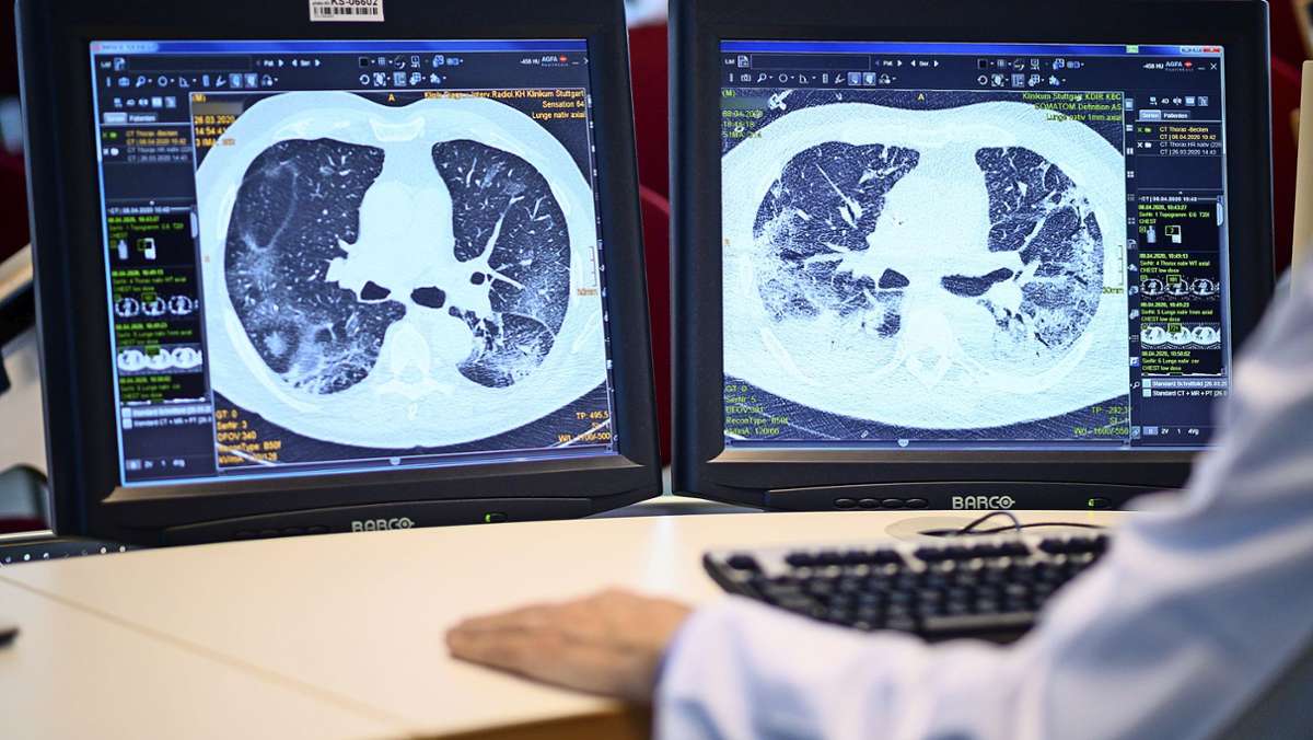 Klinikum Esslingen: Mit Lungensport gegen Langzeitfolgen