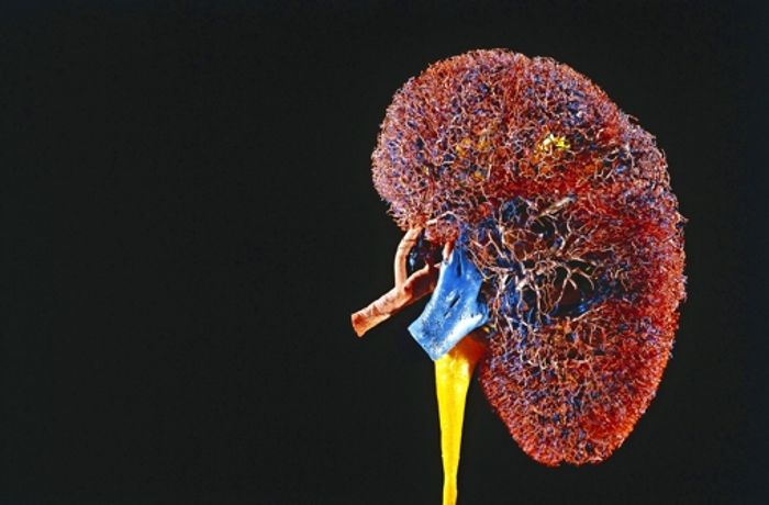 Weltweiter Organhandel: Die gekaufte Niere