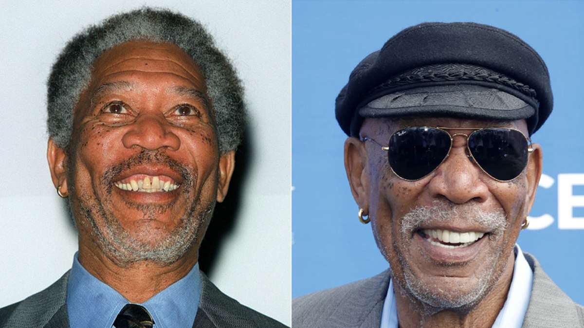 Im Jahr 2000 sahen Morgan Freemans Zähne noch ganz anders aus.