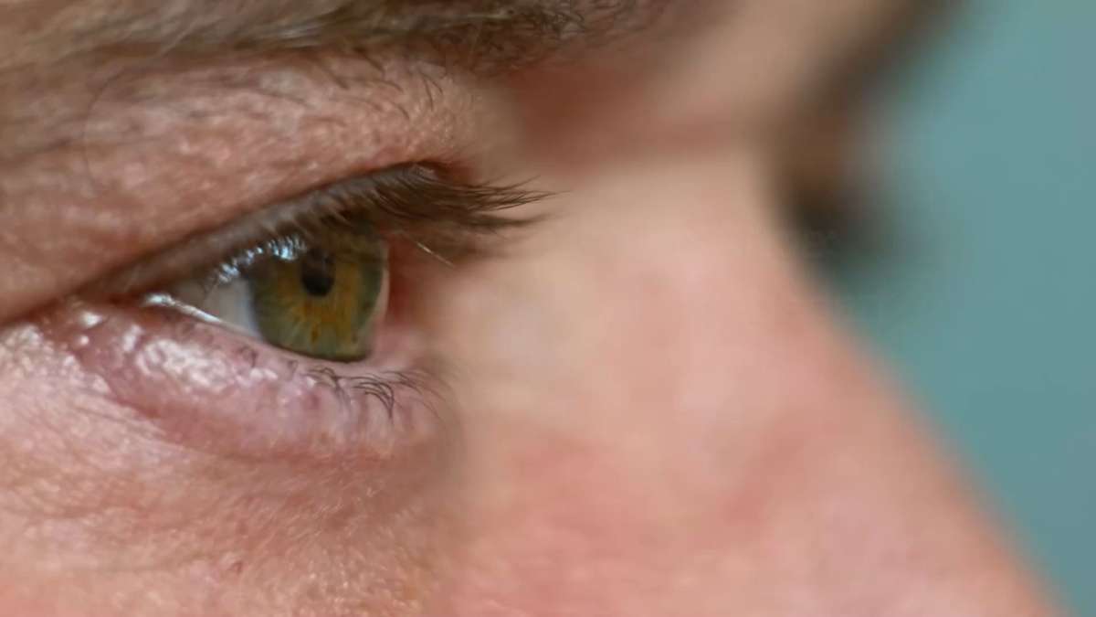 Schwarze Punkte im Auge: Ursachen und Handlungsbedarf