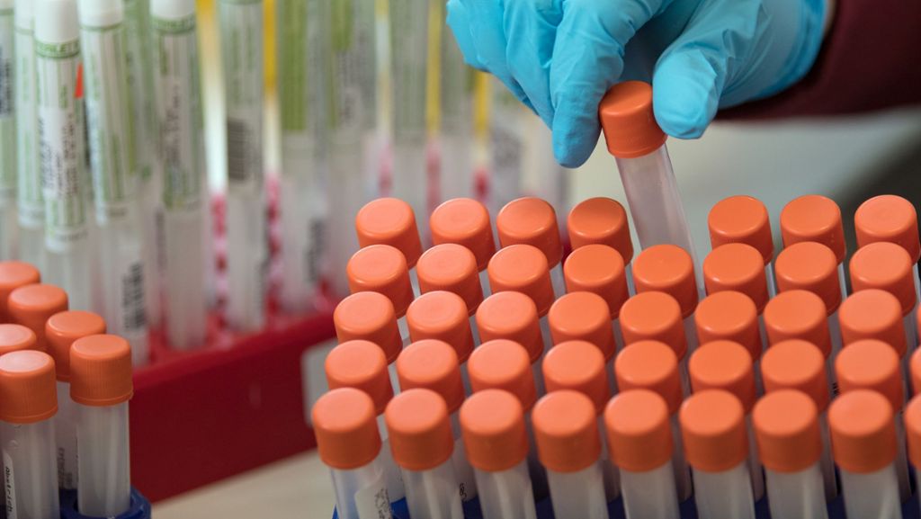 Coronavirus: Land will mehr Corona-Tests - aber nicht für alle