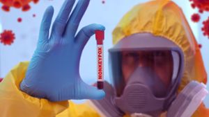 Mpox-Ausbruch: WHO warnt vor globalen Risiken