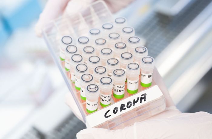 Schnelle PCR-Tests: Sind sie die Lösung?
