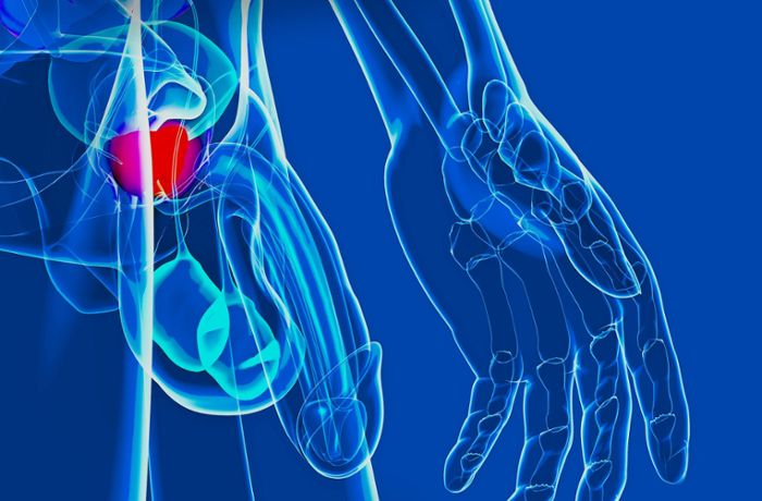 Rat der Urologen: Wie Mann den Prostatakrebs überleben kann