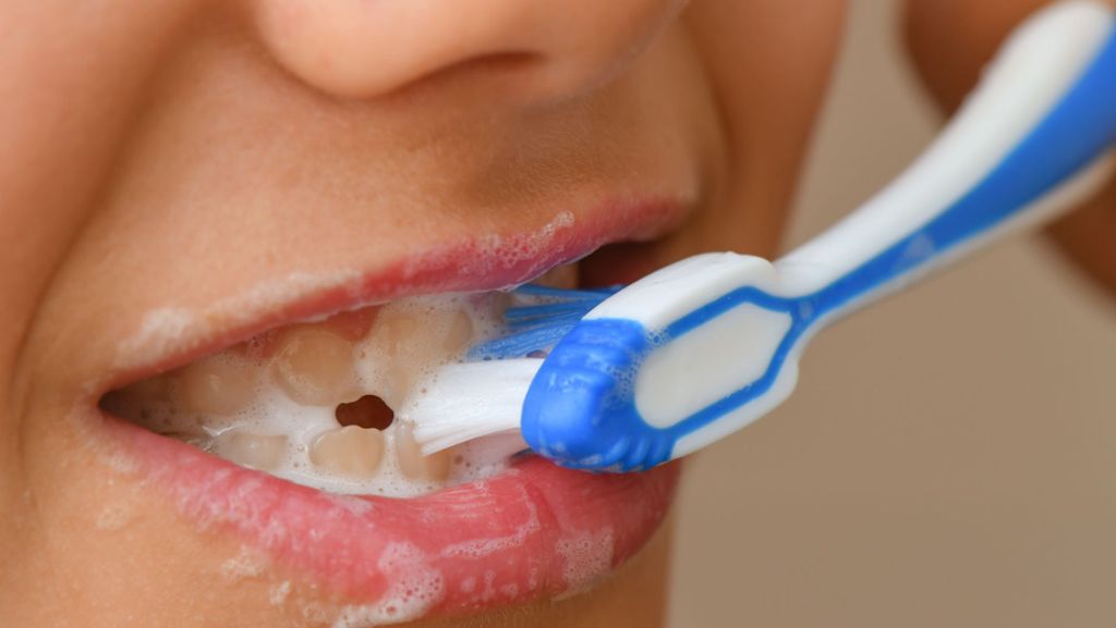 Zähneputzen, Zahnreinigung und Co.: Tipps für  gesunde und weiße Zähne