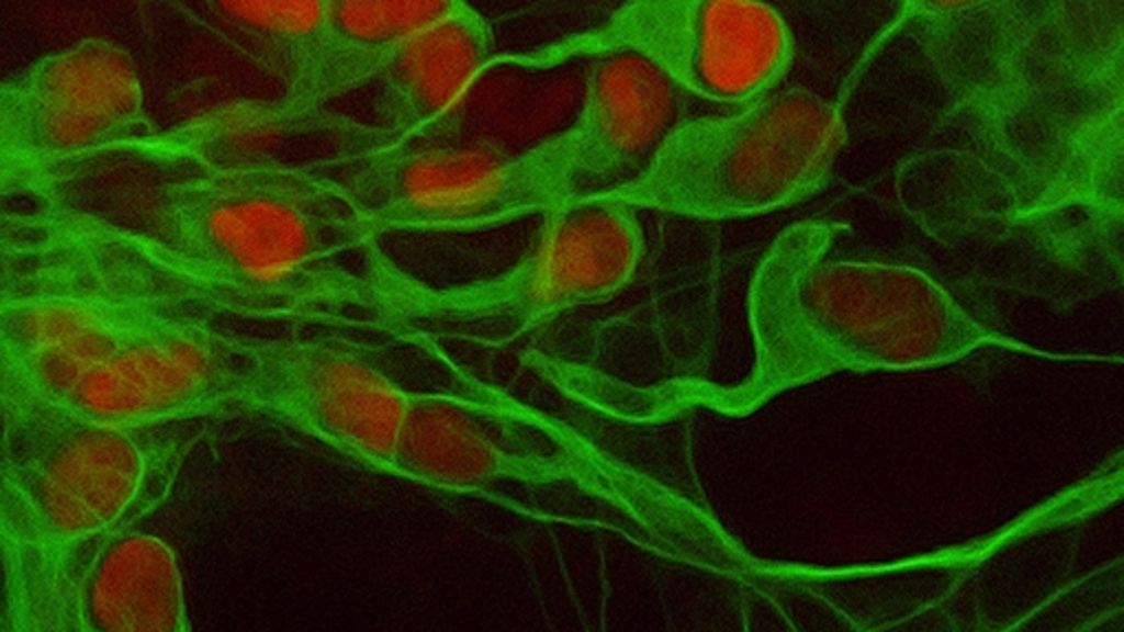 Stammzellen von Patienten mit Parkinson werden in Nervenzellen umgewandelt. An diesen Zellen sollen Hunderttausende Substanzen gegen das Leiden getestet werden. Koordiniert wird das Projekt von dem international bekannten Stammzellforscher Hans Schöler. 
