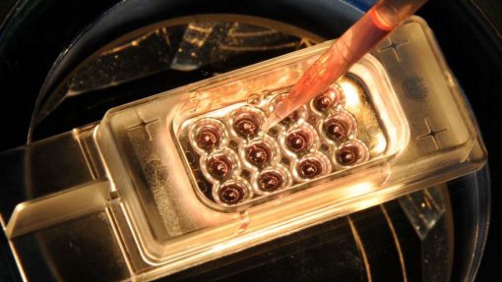  Paare mit problematischen Gen-Anlagen können ihre Embryonen aus dem Reagenzglas bald mit Gentests auf schwere Defekte untersuchen lassen. Der Bundesrat machte den Weg für die  Präimplantationsdiagnostik (PID) frei. 