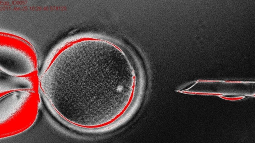  Der Mannheimer Bioethiker Jochen Taupitz rät beim Thema Klonen menschlicher Zellen zur Gelassenheit. Laut Gesetz hätten menschliche Embryonen ohnehin einen geringeren Schutz als Säuglinge. 