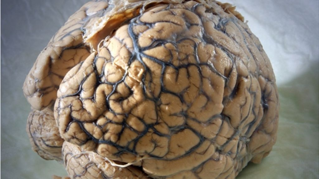 Hirnforschung: Nun wird beim Human Brain Project geschlichtet