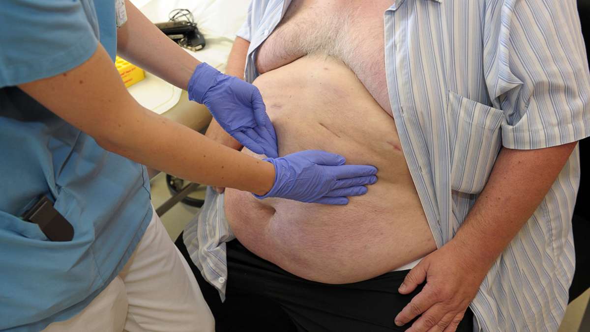 Baden-Württemberg: Immer mehr Menschen sind krankhaft übergewichtig