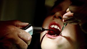 Quecksilber-Zahnfüllungen ab 2025 verboten