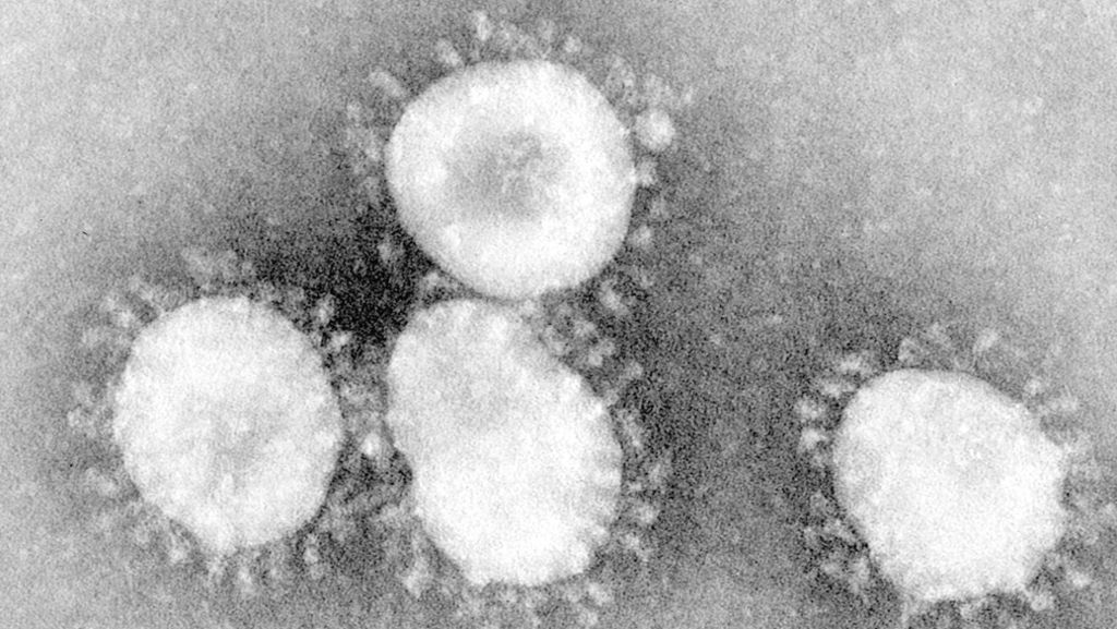 Corona-Virus in Asien: Ausmaß von mysteriöser Lungenkrankheit offenbar viel größer