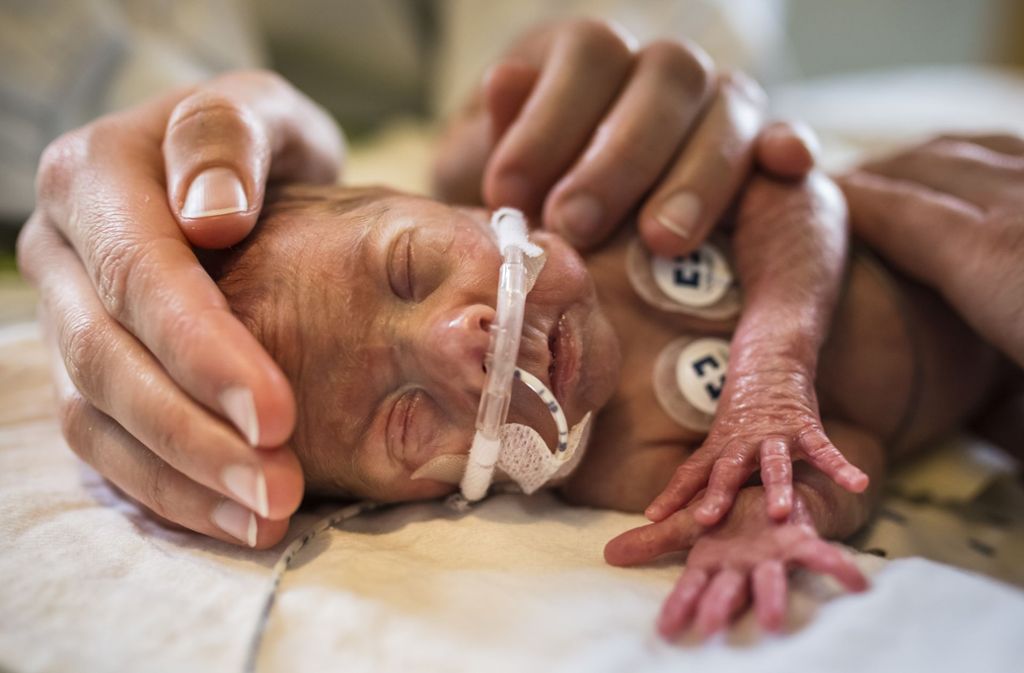 Auf der Intensivstation des Perinatalzentrums der Freiburger Uniklinik kämpfen sich die Babys in die Welt.