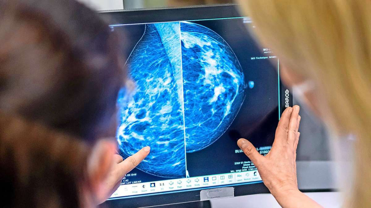 Heilungschancen bei Brustkrebs: „Der effektiven Früherkennung kommt eine sehr wichtige Aufgabe zu“
