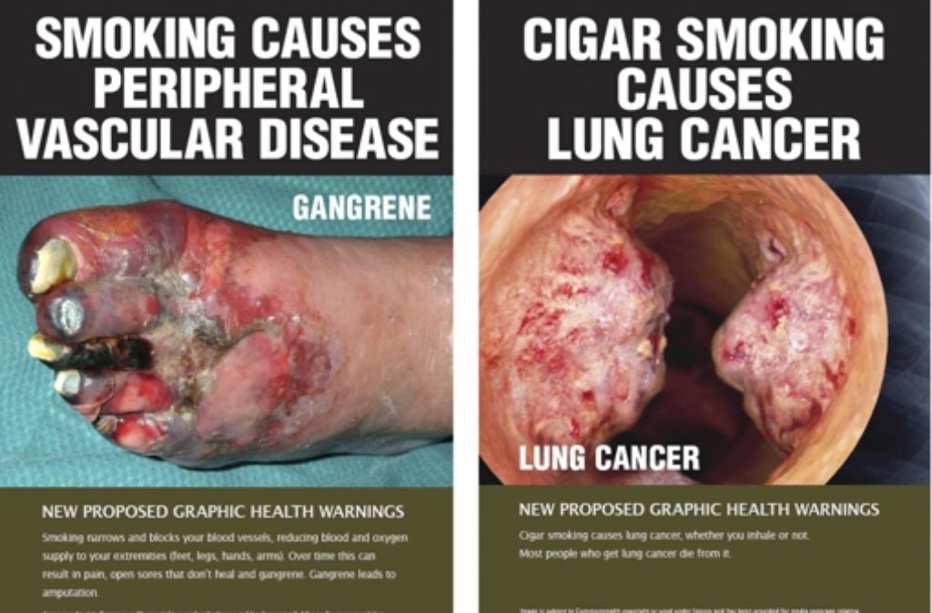 Solche Hinweise sollen künftig auf australischen Zigarettenschachteln stehen.