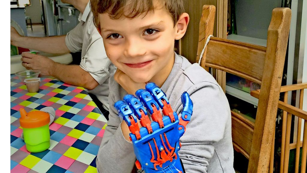 Prothesen für behinderte Kinder: Kinderhände aus dem 3-D-Drucker