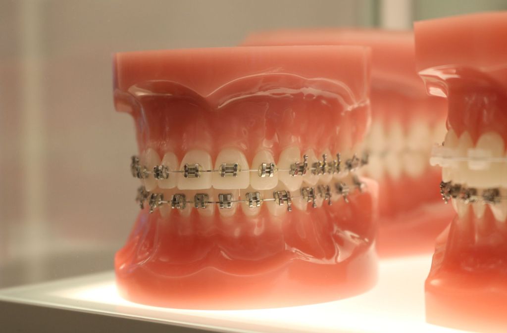 Sind Füllungen oder Kronen im Gebiss beschädigt, dann löst dies ebenfalls heftiges Zahnweh beim Essen aus. Gleiches gilt für Zahnfleischentzündungen.