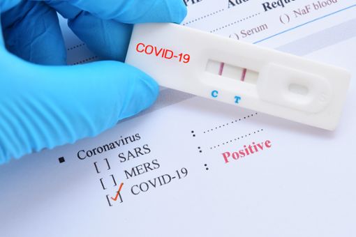 Corona-Test trotz Impfung positiv: Was jetzt? Foto: Jarun Ontakrai / shutterstock.com