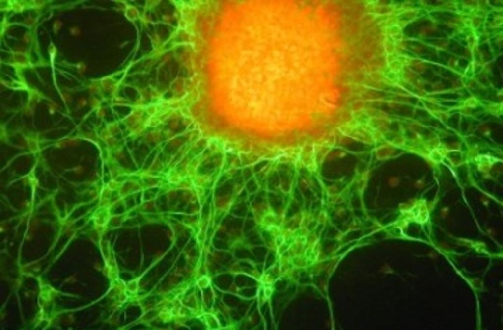 Krebsstammzellen können Tumore wachsen lassen. Foto: University of Rochester
