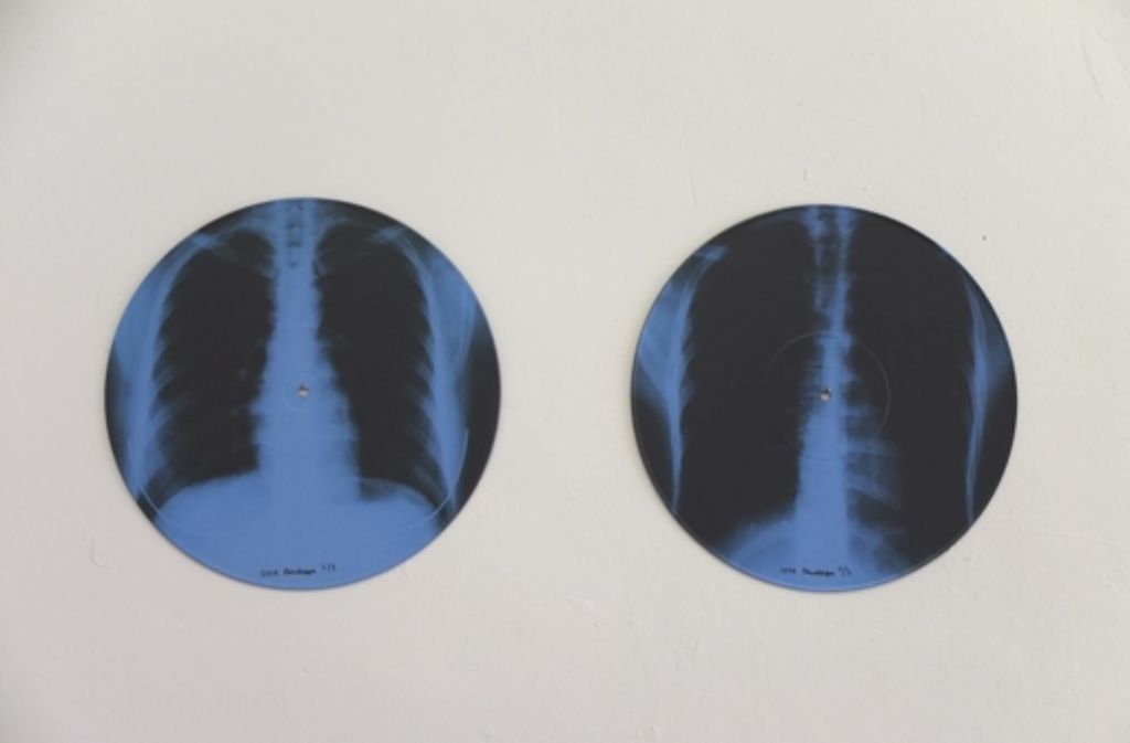 Bagus Pandega hat Röntgenbilder auf Vinyl gedruckt ...