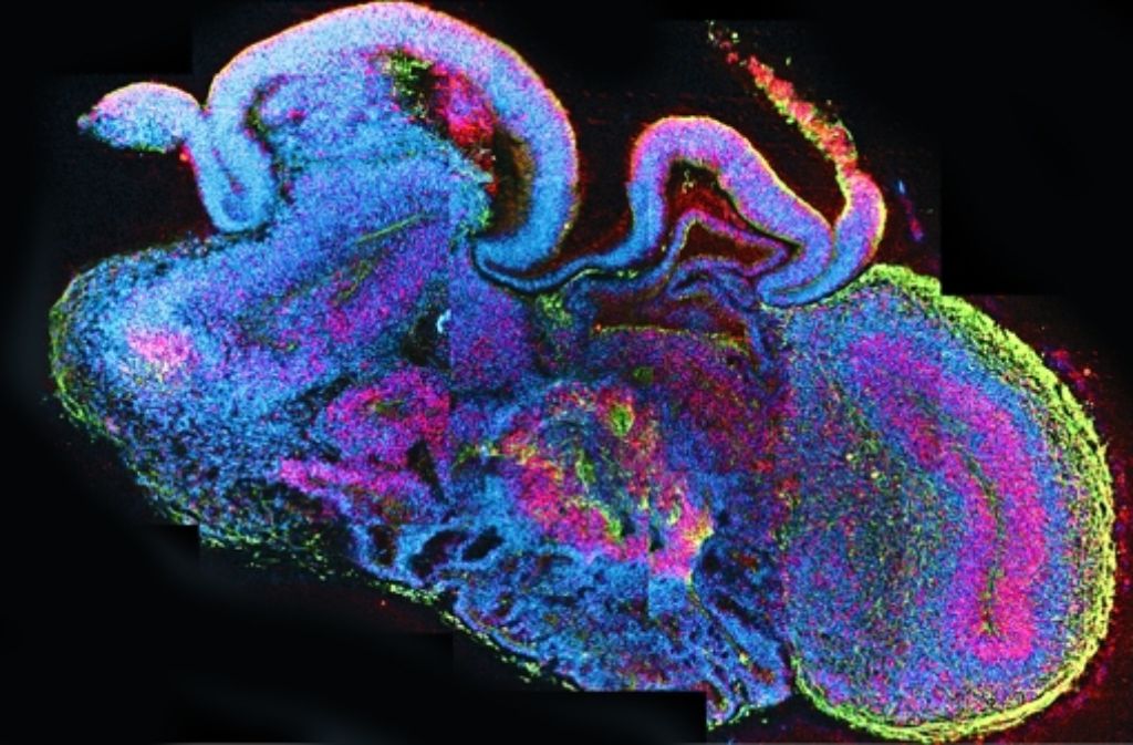 Querschnitt durch ein vier Millimeter großes künstliches Gehirn: Die Nervenzellen sind grün eingefärbt, und die Stammzellen, aus denen sie sich entwickeln, in Rot. Foto: Lancaster