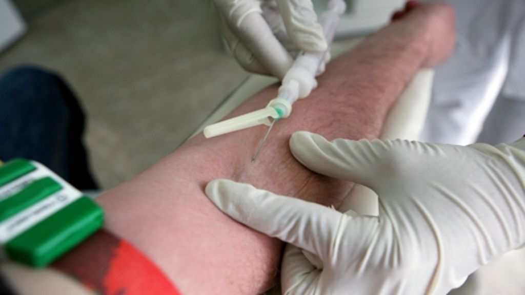 Gesundheit: HIV-Test liefert nun früher ein Ergebnis