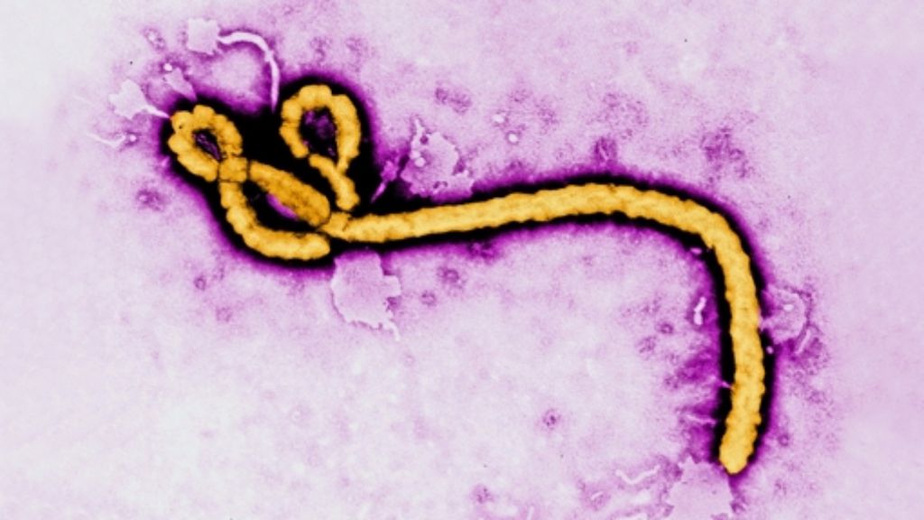 Ebola-Virus: Forscher entdecken Mutationen im Erbgut